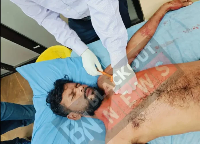 Wife attacked husband with a knife 