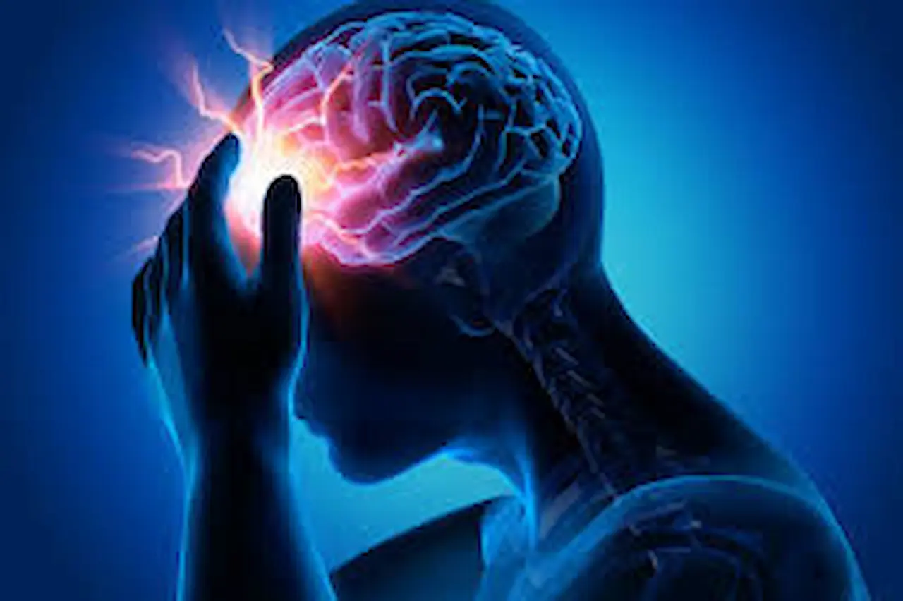 Home remedies for migraine