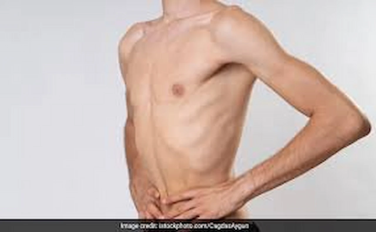 Causes of sudden weight loss