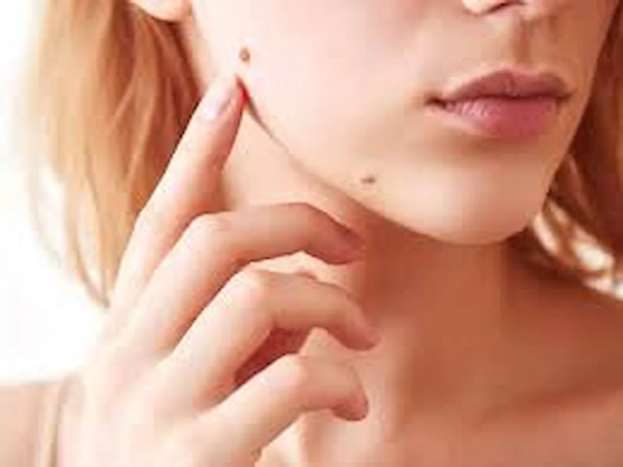 home remedies for warts