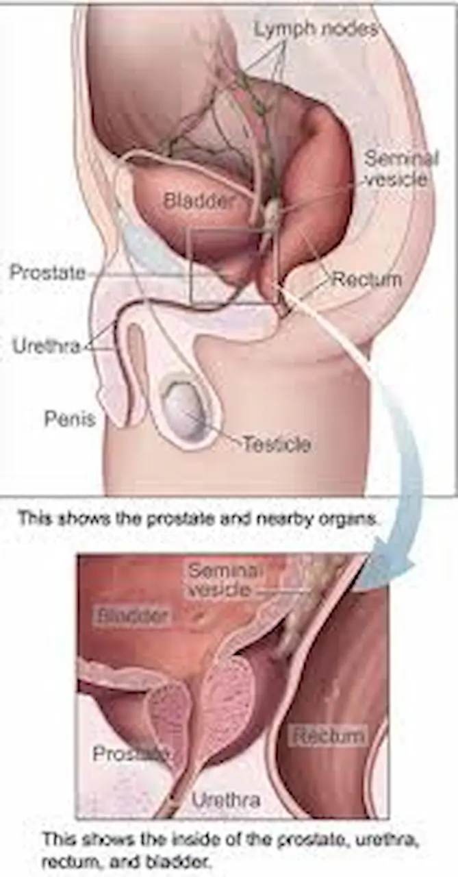 home treatment for prostate