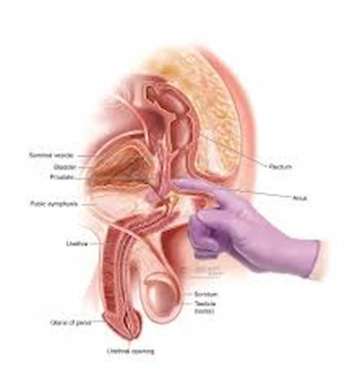home treatment for prostate