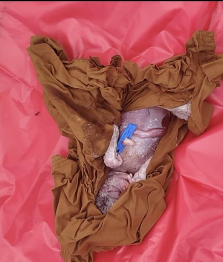 Dead body of a newborn baby found in a bag