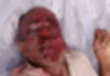 कोरबा: पसान क्षेत्र में अधेड़ की लाश मिलने से सनसनी, हत्या की आशंका